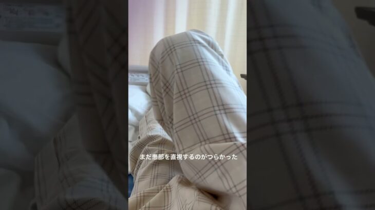 術後6日目#糖尿病 #2型糖尿病#切断手術
