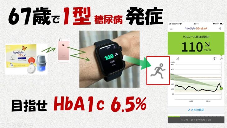 67歳で1型糖尿病発症