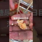 溶けた花咲ガニ一応食べといた糖尿病890日目食事記録  #糖尿病の品格 #糖尿病 #心筋梗塞 #血糖値 #hba1c #カニ