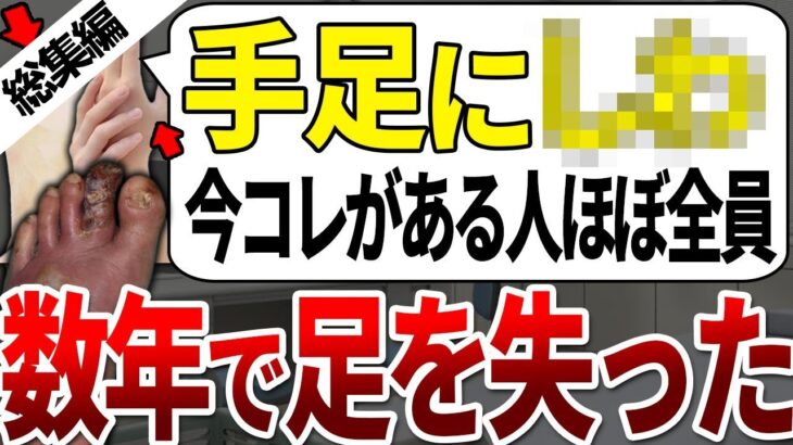 【総集編】糖尿病で足を失った人の99%の人は、数年以内に体にコレが出ていました。【ゆっくり解説】