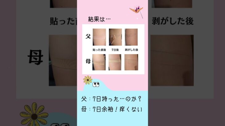 【一型糖尿病】CGMの肌荒れにはコレ！！一度使ってみて！