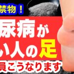 糖尿病が近い人だけに起こる「足の異変」見逃すと足を失います！