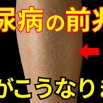【知らないと後悔】糖尿病肌に出る危険なサイン