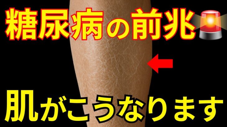 【知らないと後悔】糖尿病肌に出る危険なサイン