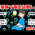糖尿病で両足切断したけど質問ある？