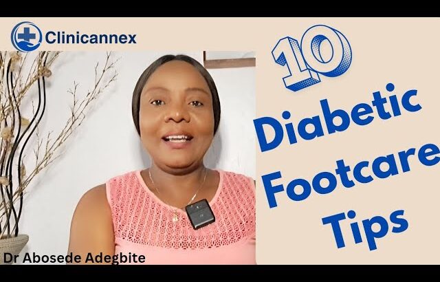 10 Diabetic Footcare Tips