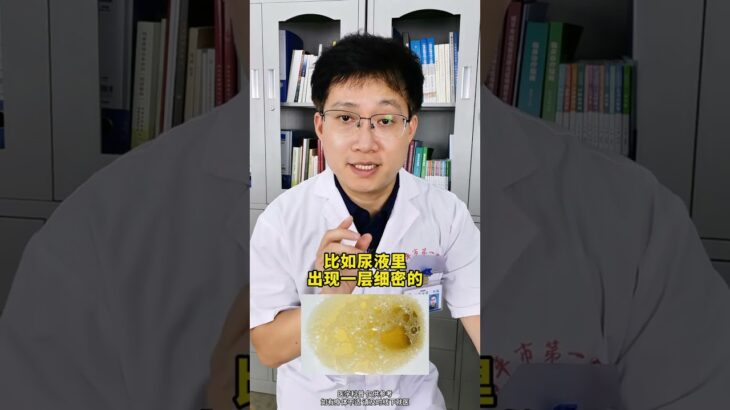 糖尿病腎病到尿毒癥，有3個階段 #糖尿病腎病 #尿毒癥 #尿蛋白高 #抖出健康知識寶藏  #健康科普有真知