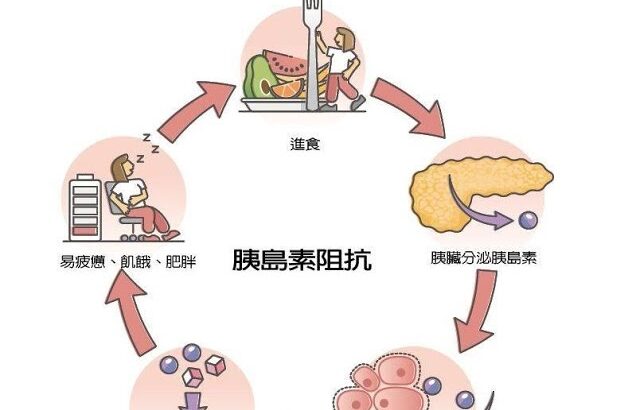 胰島素阻抗警訊！肥胖不運動恐變糖尿病 醫師教你3招逆轉
