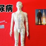 第8期：治疗糖尿病~道家秘传灵针【悬针术】~内分泌科第1个针方
