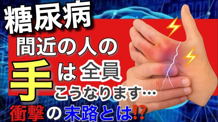 【超危険】糖尿病予備軍の9割が見逃す！手の危険な症状とは…⁉︎