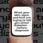 Don’t ignore the Symptoms 🙂 | #sugar #diabetes #health