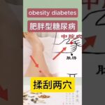 肚子大、舌苔厚？你可能是“水桶型糖尿病”！#shorts#温哥华中医#糖尿病#穴位调理