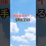 糖尿病のサイン 手に現れる #雑学 #shorts