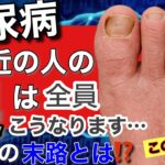 【衝撃】糖尿病間近の人の足は全員こうなります！ちょっとした変化でも見落とすと足切断です。