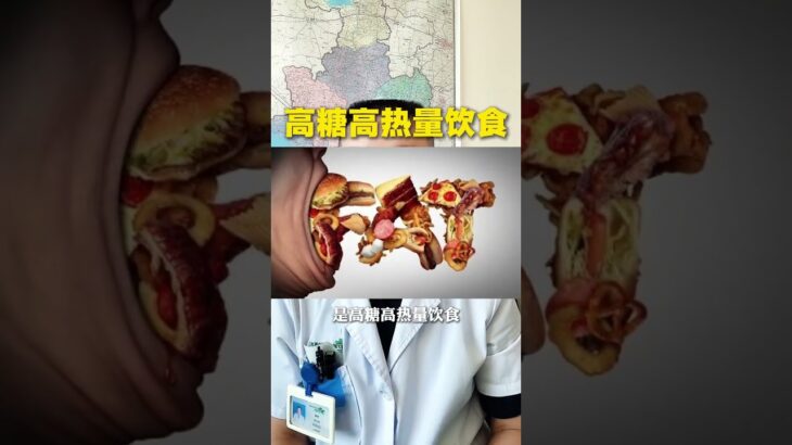 泰国的和尚比较胖，糖尿病高发 为什么清规戒律挡不住和尚肥胖#抖出健康知识宝藏 #和尚 #肥胖 #糖尿病 #全民健康素养提升