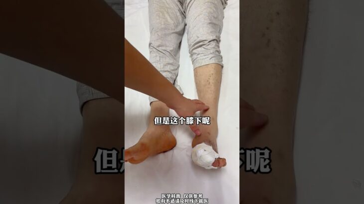 糖尿病足要戒糖，西瓜甜食不能碰 #健康科普有真知 #医学科普 #抖出健康知识宝藏 #糖尿病足