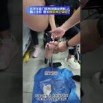 【糖足保肢门诊】糖足伤口疼到叫？到底为啥这么疼？ #抖出健康知识宝藏  #糖足保肢  #糖尿病足  #鞠上 #糖尿病饮食