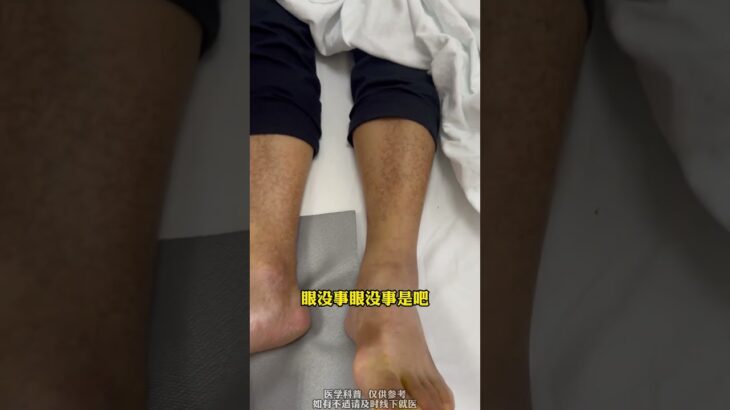 脚麻脚凉，血糖高。警惕糖尿病病变 #健康科普有真知 #医学科普 #抖出健康知识宝藏 #静脉曲张