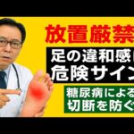 【放置厳禁】その足の違和感は危険サイン？糖尿病が知らせる初期症状と切断を防ぐ方法