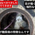 糖尿病
