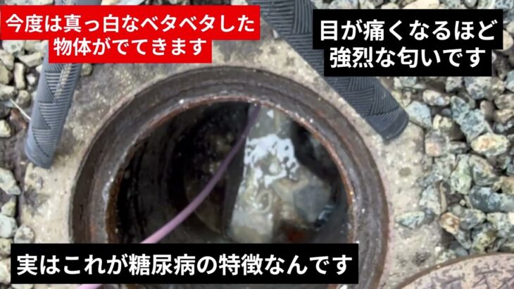 糖尿病