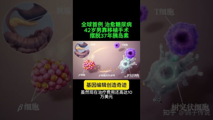 0909-全球首例！ 42岁男靠移植手术「治愈糖尿病」　摆脱37年胰岛素  #健康 #全球首例 #糖尿病 #胰岛素 #基因编辑 #创造奇迹