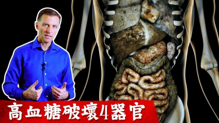 高血糖破壞4器官,腎臟,眼睛,血管疾病,糖尿病原因?低碳水,控制胰島素很重要！柏格醫生Dr Berg
