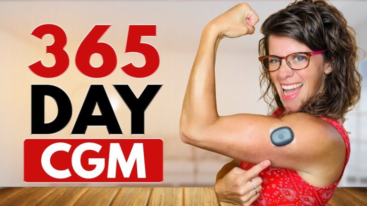 Eversense 365-Day CGM Review: Is it Worth it with T1D?
