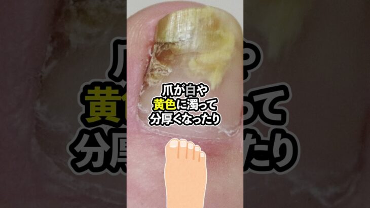 【要確認！】糖尿病の隠れたSOS…足に出る危険なサイン3つを現役医師が解説！