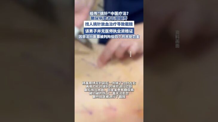 糖尿病患者長期腿疼， 找人挑針放血治療導致截肢（荔枝新聞）