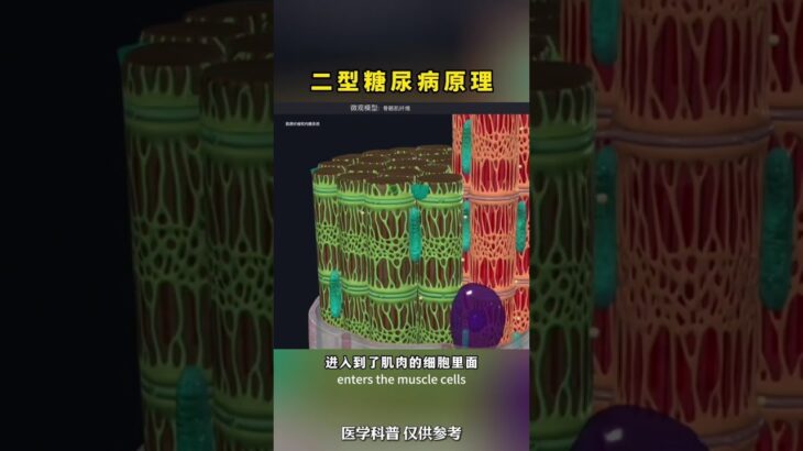 糖尿病真的可以逆转
