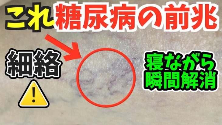 【放置厳禁】太って老化も加速させる糖尿病で起きやすい【細絡】腰振るだけで全身の不調を解消！寝ながら骨盤矯正ストレッチ&セルフケア『ダイエット・老化防止・夜間頻尿・足よくつる・腰痛・股関節痛・動脈硬化』