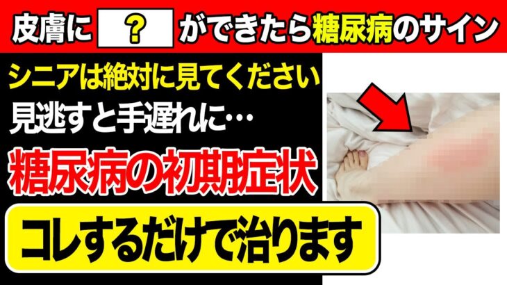 【有益】皮膚に現れる“隠れ糖尿病”のサイン！専門家も注目するかゆみ・黒ずみ・ブツブツを見逃さないための対策法