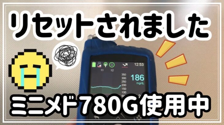 【1型糖尿病】緊急事態！？スマートガードが使えない！マニュアルモードで対応　インスリンポンプ780G使用中