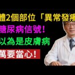 身體2個部位「異常發癢」，竟是糖尿病前兆！再不注意就晚了！#健康知识#老年健康#健康养生#健康之眼