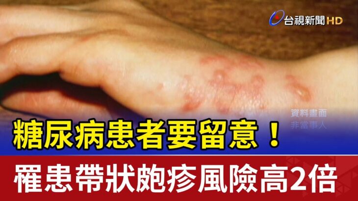 糖尿病患者要留意！ 罹患帶狀皰疹風險高2倍