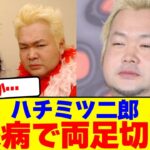 ハチミツ二郎が糖尿病で両足切断…【2chまとめ】【2chスレ】【5chスレ】