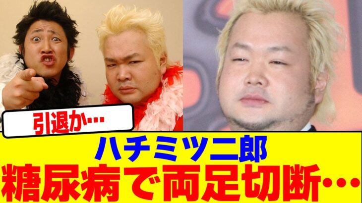 ハチミツ二郎が糖尿病で両足切断…【2chまとめ】【2chスレ】【5chスレ】