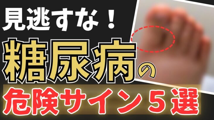 【放置禁】絶対に見逃さないで！糖尿病の初期症状5選