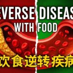 天然净化血管！逆转心脏病、糖尿病和肾脏损害的最佳饮食 Cleanse Your Blood Vessels Naturally! Best Diet to Reverse Heart Disease