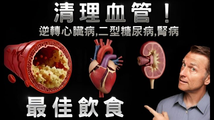 清理血管！逆轉心臟病、二型糖尿病、腎病的最佳飲食, 柏格醫生 Dr Berg