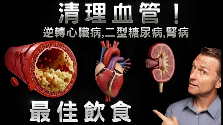 清理血管！逆轉心臟病、二型糖尿病、腎病的最佳飲食, 柏格醫生 Dr Berg