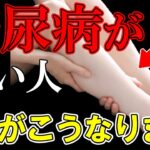 糖尿病が近い人だけに起こる「足の異変」症状から予防法まで解説【食事｜血糖値｜ヘモグロビンエーワンシー｜高血糖｜HbA1c】