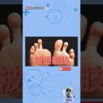 糖尿病腳最可怕的不是傷口，而是『沒有感覺』 #糖尿病 #糖尿病足 #足部健康 #周邊神經病變 #糖尿病併發症 #健康知識 #截肢預防 #醫學知識 #diabetescare #健康知識