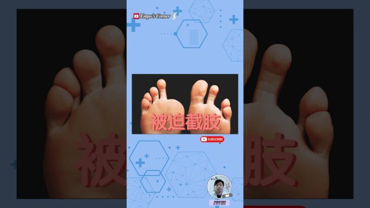糖尿病腳最可怕的不是傷口，而是『沒有感覺』 #糖尿病 #糖尿病足 #足部健康 #周邊神經病變 #糖尿病併發症 #健康知識 #截肢預防 #醫學知識 #diabetescare #健康知識