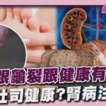腳後跟龜裂跟健康有關! 重症醫曝光恐是糖尿病 全麥吐司高纖超健康? 腎病注意動脈鈣化危機｜健康儀點靈   @tvbshealth20​