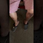 膝部下肢呈黑色 腎臟病 糖尿病