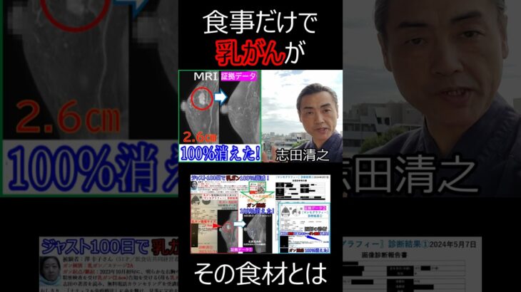 【乳がん食事】乳がんが消える食事 #乳がん食事 #乳がんが消える食事 #がんが消える食事