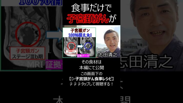 【子宮頚がん食事】子宮頚がんが消える食事 #子宮頚がん食事 #子宮頚がんが消える食事 #がんが消える食事