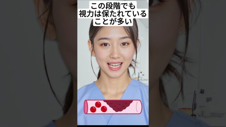 糖尿病網膜症の病期について【専門医解説】